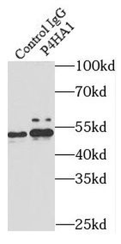 P4HA1 Rabbit Polyclonal Antibody