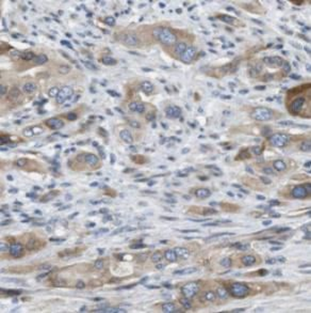 P4HA1 Rabbit Polyclonal Antibody