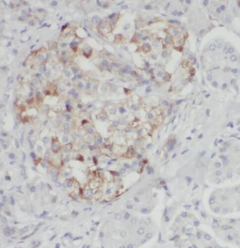 P4HA2 Antibody