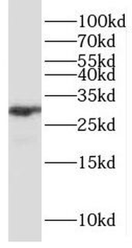 P4HA3 Rabbit Polyclonal Antibody