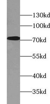 PABPC1 Rabbit Polyclonal Antibody