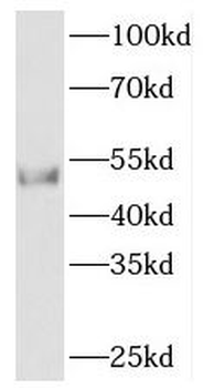 PACSIN1 Rabbit Polyclonal Antibody