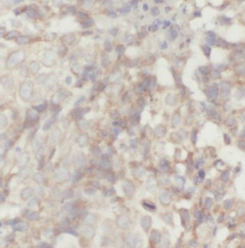 PACSIN2 Rabbit Polyclonal Antibody