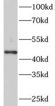 PADI2 Antibody