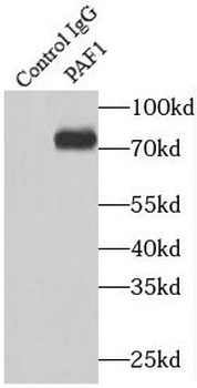 PAF1 Rabbit Polyclonal Antibody