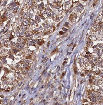 PAF1 Rabbit Polyclonal Antibody