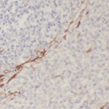 PAFAH1B3 Rabbit Polyclonal Antibody