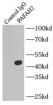 PAFAH2 Rabbit Polyclonal Antibody