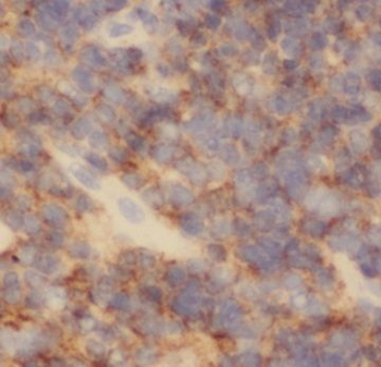 PAFAH2 Rabbit Polyclonal Antibody