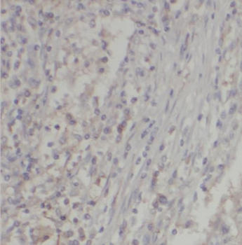 SERPINE1 Rabbit Polyclonal Antibody