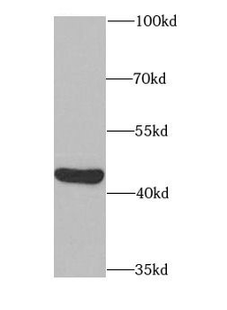 PAICS Rabbit Polyclonal Antibody