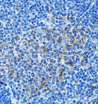 PAICS Rabbit Polyclonal Antibody