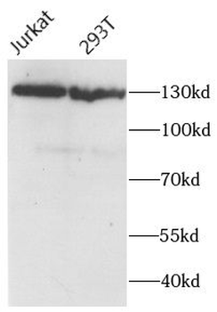 PALB2 Rabbit Polyclonal Antibody