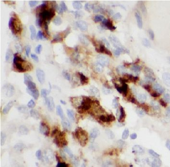 PALB2 Rabbit Polyclonal Antibody