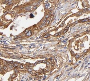 PNLIP Rabbit Polyclonal Antibody