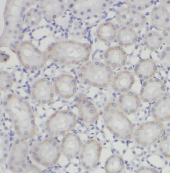 PANX1 Rabbit Polyclonal Antibody