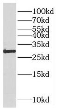 PARP11 Rabbit Polyclonal Antibody