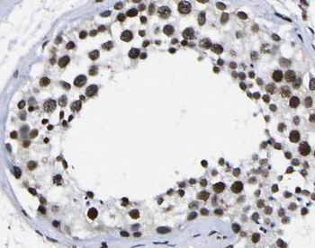 PARP11 Rabbit Polyclonal Antibody