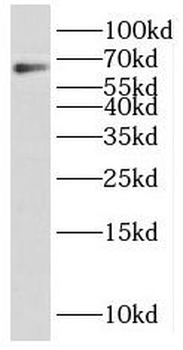 PARP2 Rabbit Polyclonal Antibody