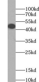 PAX8 Mouse Monoclonal Antibody