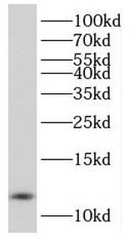 PCBD1 Rabbit Polyclonal Antibody