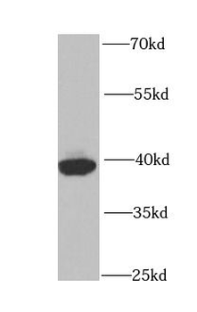 PCBP2 Rabbit Polyclonal Antibody