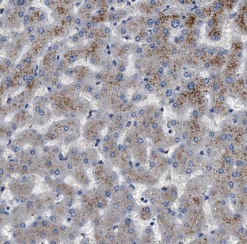 PCCA Rabbit Polyclonal Antibody