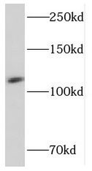 PCDH1 Rabbit Polyclonal Antibody