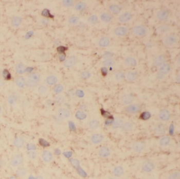 PCDHA3 Rabbit Polyclonal Antibody