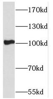 PCDHA5 Rabbit Polyclonal Antibody