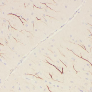 PCDHA5 Rabbit Polyclonal Antibody