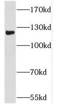 PCDHA6 Rabbit Polyclonal Antibody
