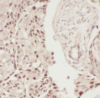 PCK2 Rabbit Polyclonal Antibody