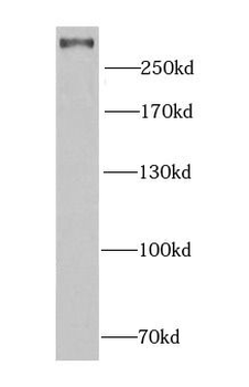 PCM1 Rabbit Polyclonal Antibody