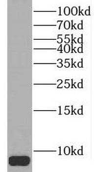 PCP4 Rabbit Polyclonal Antibody
