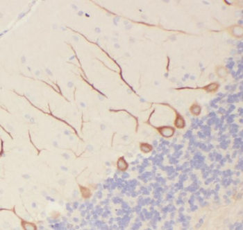 PCP4 Rabbit Polyclonal Antibody