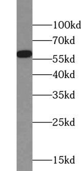 CDK16 Rabbit Polyclonal Antibody