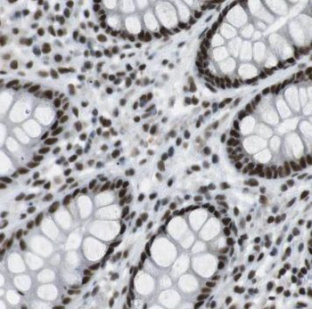 PCYOX1 Rabbit Polyclonal Antibody