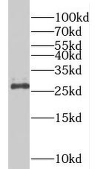 PDCD10 Rabbit Polyclonal Antibody