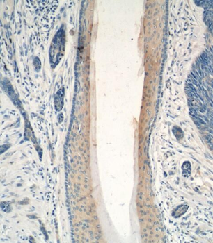 PDCD5 Rabbit Polyclonal Antibody