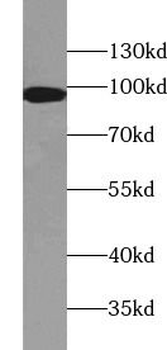 PDCD6IP Rabbit Polyclonal Antibody