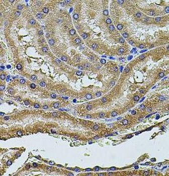 PDCD6IP Rabbit Polyclonal Antibody