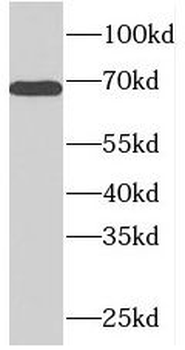 PDE1C Rabbit Polyclonal Antibody