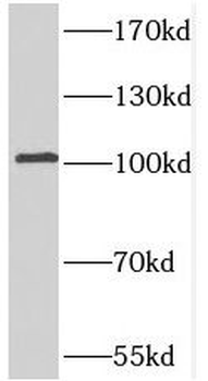 PDE2A Rabbit Polyclonal Antibody