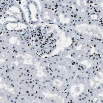 PDE2A Rabbit Polyclonal Antibody