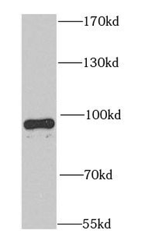 PDE4D Rabbit Polyclonal Antibody