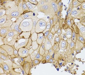 PDE4D Rabbit Polyclonal Antibody