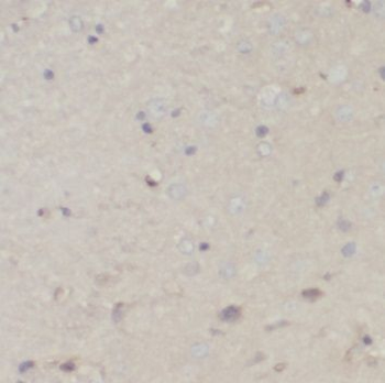 PDHA1 Rabbit Polyclonal Antibody