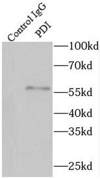P4HB Antibody