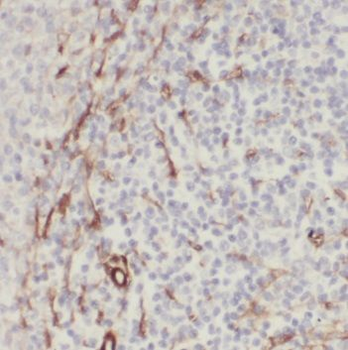 PDIA6 Antibody